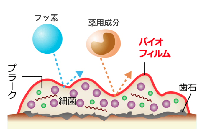 バイオフィルムとは? 歯磨きだけでは落としにくい「お口の細菌の膜」